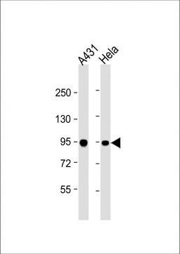 Western Blot at 1:1000 dilution Lane 1: A431 whole cell lysate Lane 2: Hela whole cell lysate Lysates/proteins at 20 ug per lane.