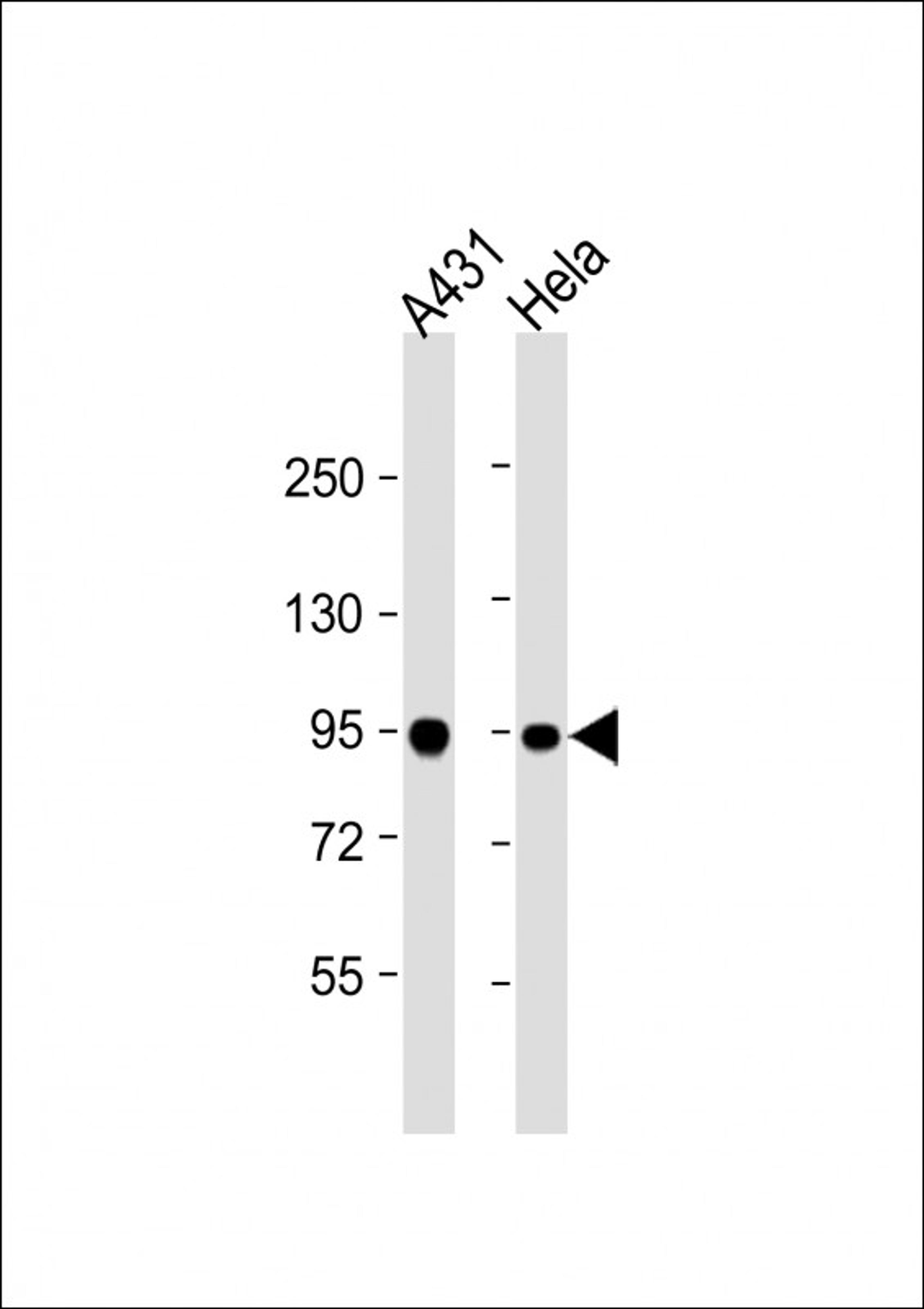 Western Blot at 1:1000 dilution Lane 1: A431 whole cell lysate Lane 2: Hela whole cell lysate Lysates/proteins at 20 ug per lane.