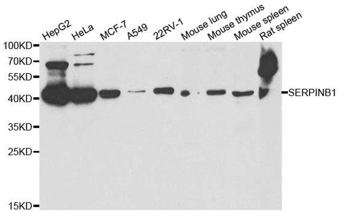 Western blot analysis of extracts of various cell lines using SERPINB1 antibody