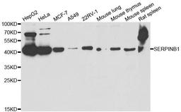 Western blot analysis of extracts of various cell lines using SERPINB1 antibody