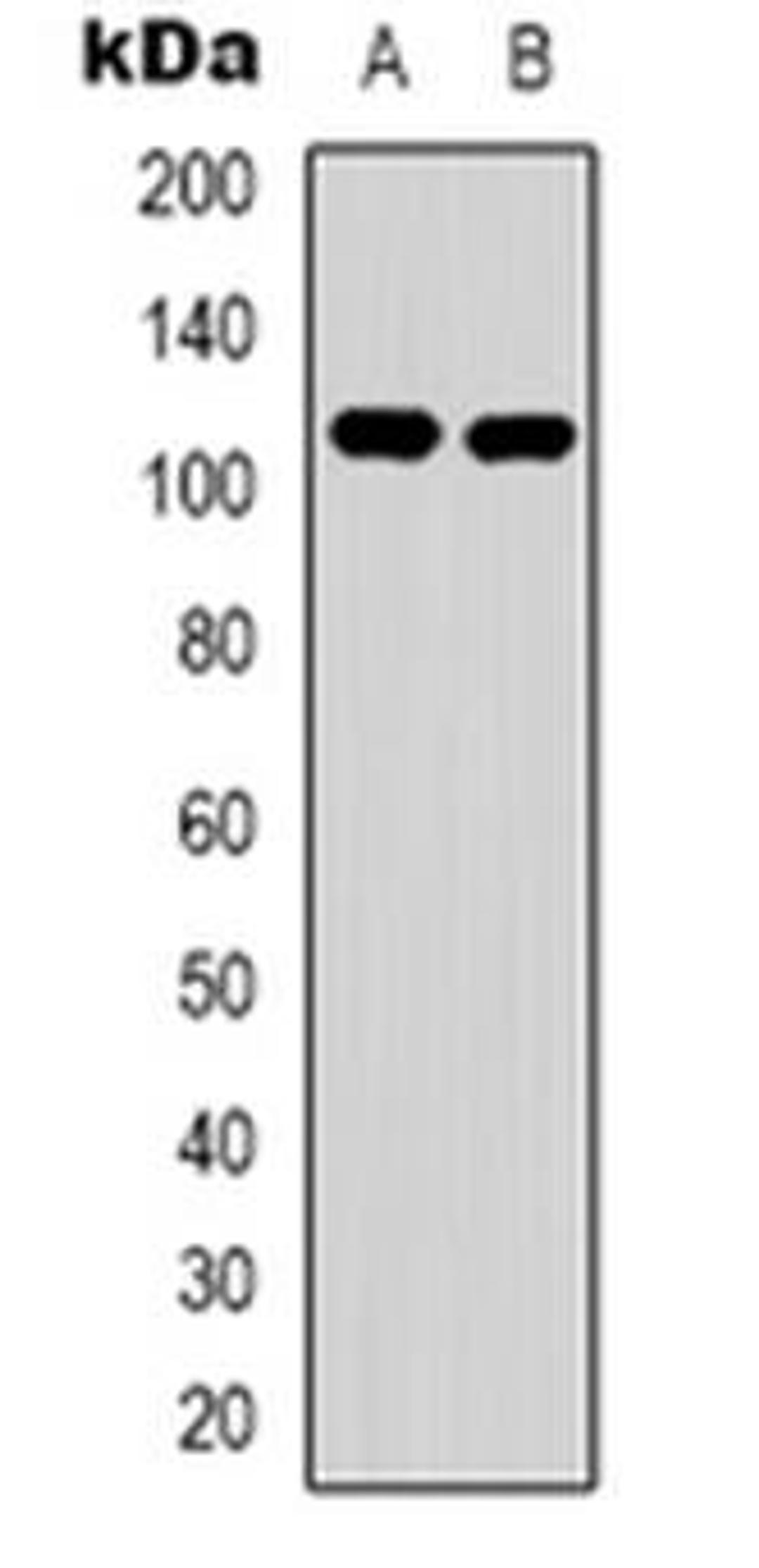 Western blot analysis of EPHA1 expression in Hela (Lane 1), HepG2 (Lane 2) whole cell lysates using EPHA1 antibody