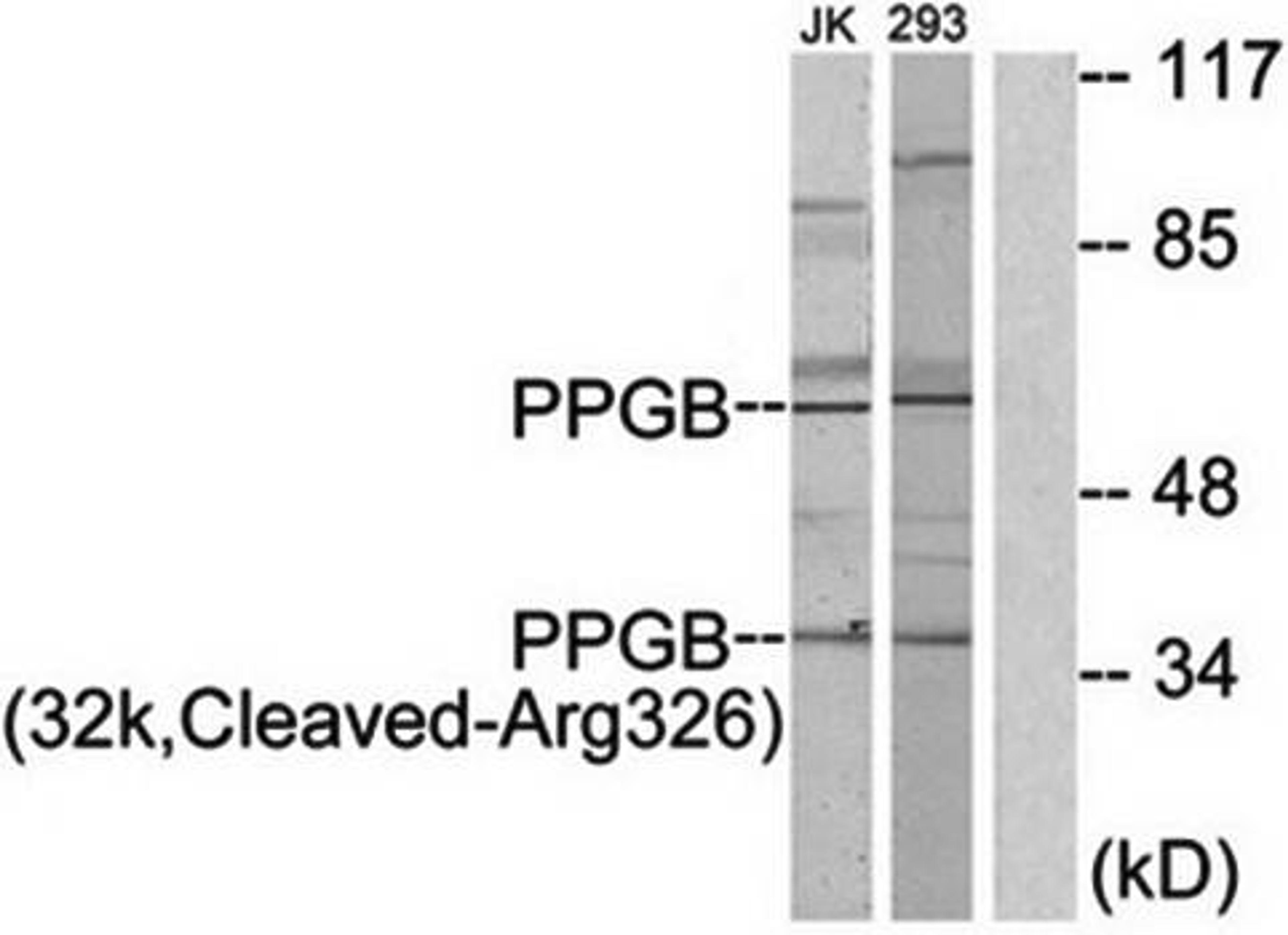 Western blot analysis of extracts from Jurkat cells and 293 cells using PPGB (32k, Cleaved-Arg326) antibody