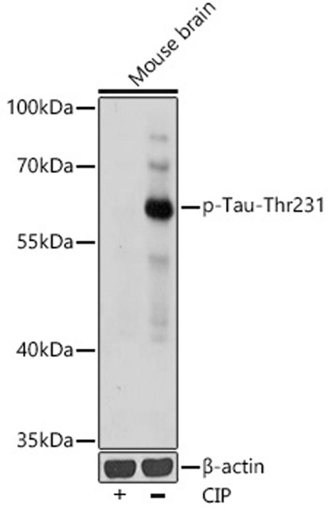 Western blot - Phospho-Tau-Thr231 antibody (AP0923)