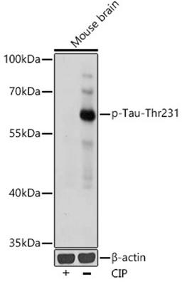 Western blot - Phospho-Tau-Thr231 antibody (AP0923)