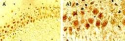 Immunohistochemistry: Cre Antibody [NB100-56134] - Immunohistochemical analysis of Cre in a formalin-fixed, paraffin embedded tissue section from the hippocampus of a Cre transgenic mouse at 1:2000. In this mouse line, Cre is expressed in the brain, predominantly in the nuclei of most types of neurons. Hematoxylin-eosin counterstain. A1 is a higher magnification of A.