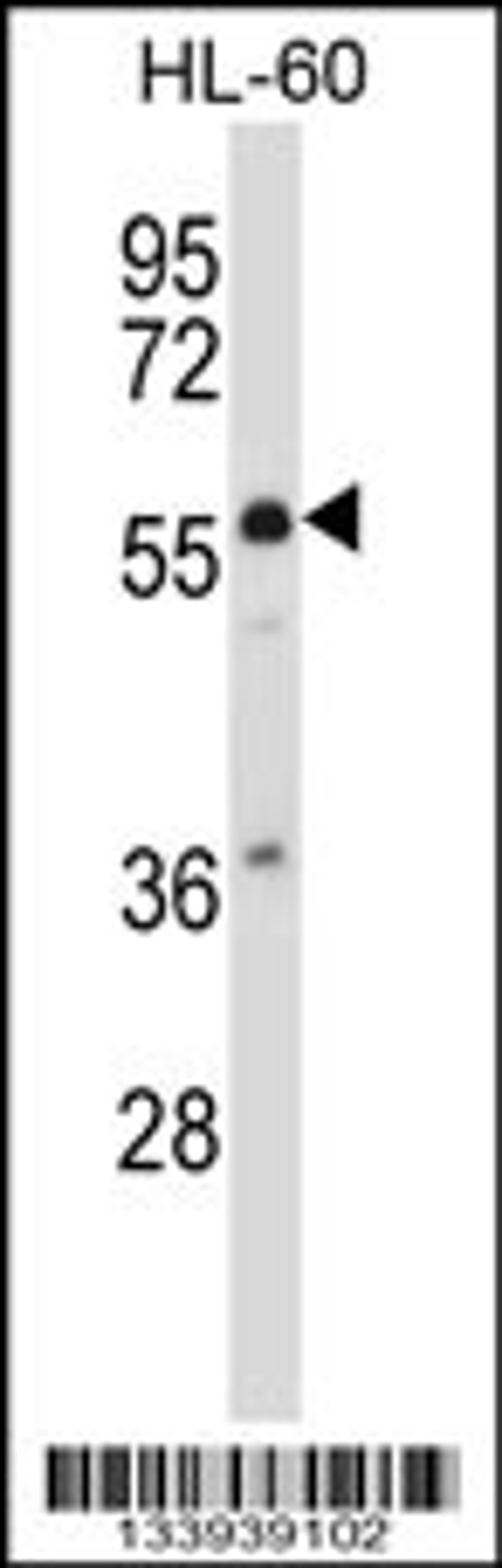 Western blot analysis in HL-60 cell line lysates (35ug/lane).