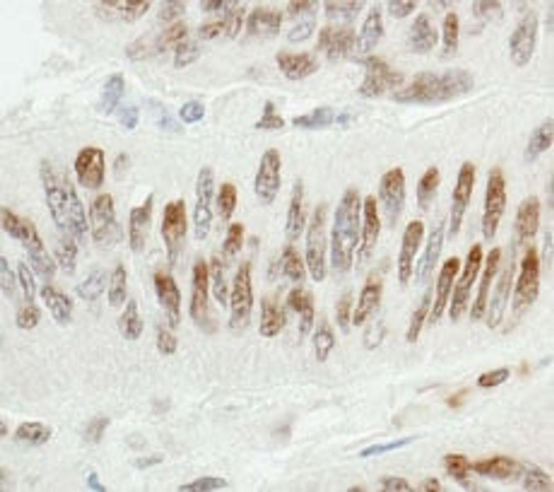 Detection of human ZBTB7/FBI-1 by immunohistochemistry.