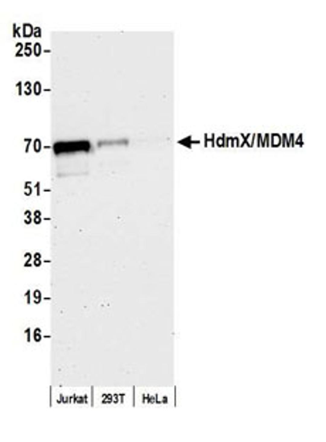 Detection of human HdmX/MDM4 by western blot.