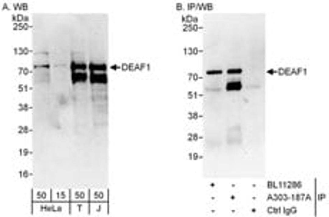 Detection of human DEAF1 by western blot and immunoprecipitation.