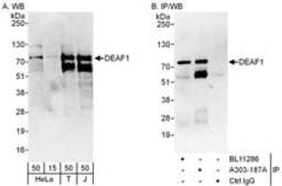 Detection of human DEAF1 by western blot and immunoprecipitation.