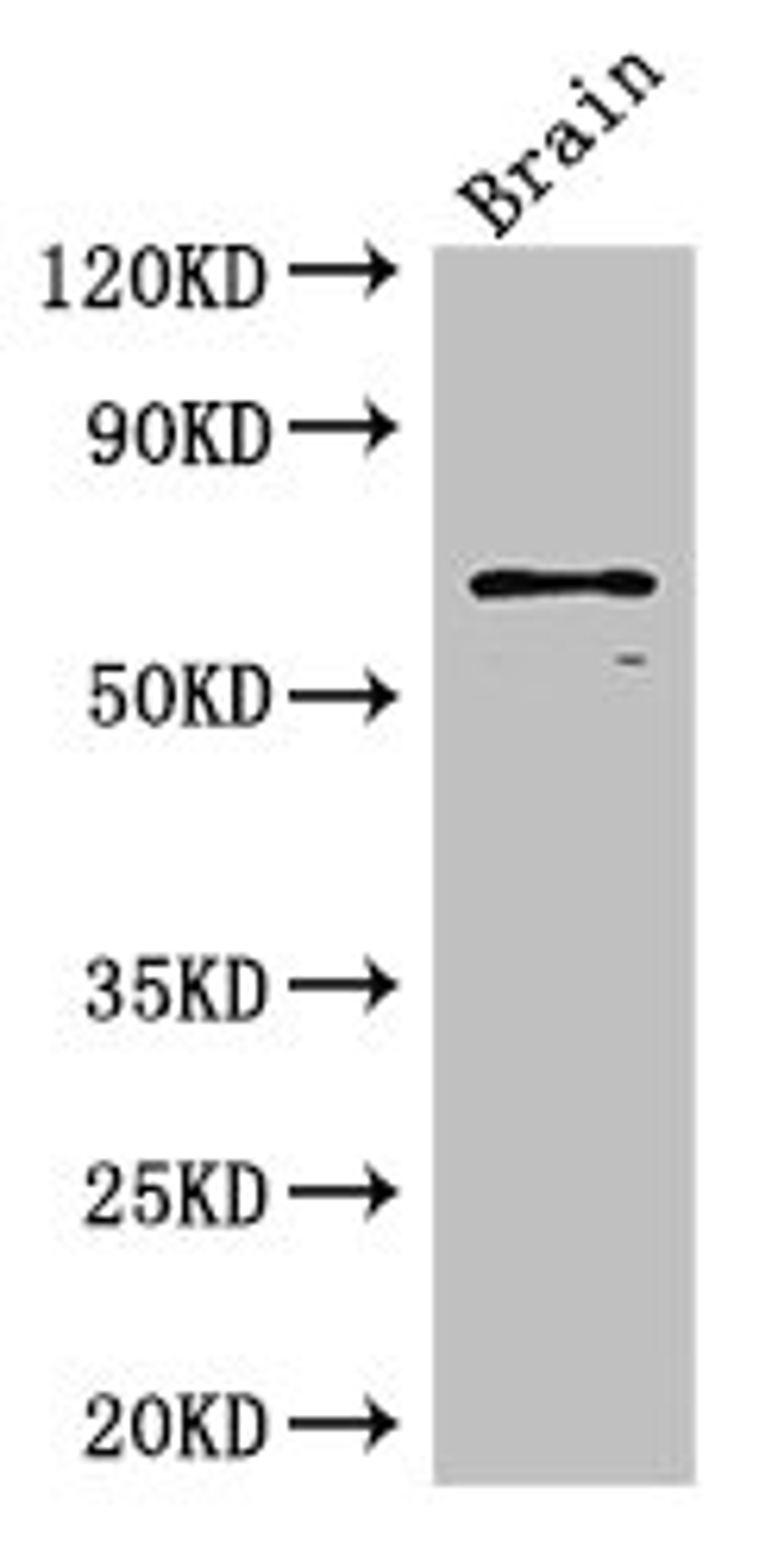 Western Blot. Positive WB detected in: Mouse brain tissue. All lanes: SLC6A3 antibody at 3ug/ml. Secondary. Goat polyclonal to rabbit IgG at 1/50000 dilution. Predicted band size: 69 kDa. Observed band size: 69 kDa.
