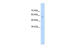 Antibody used in WB on Human HepG2 at 5.0 ug/ml.