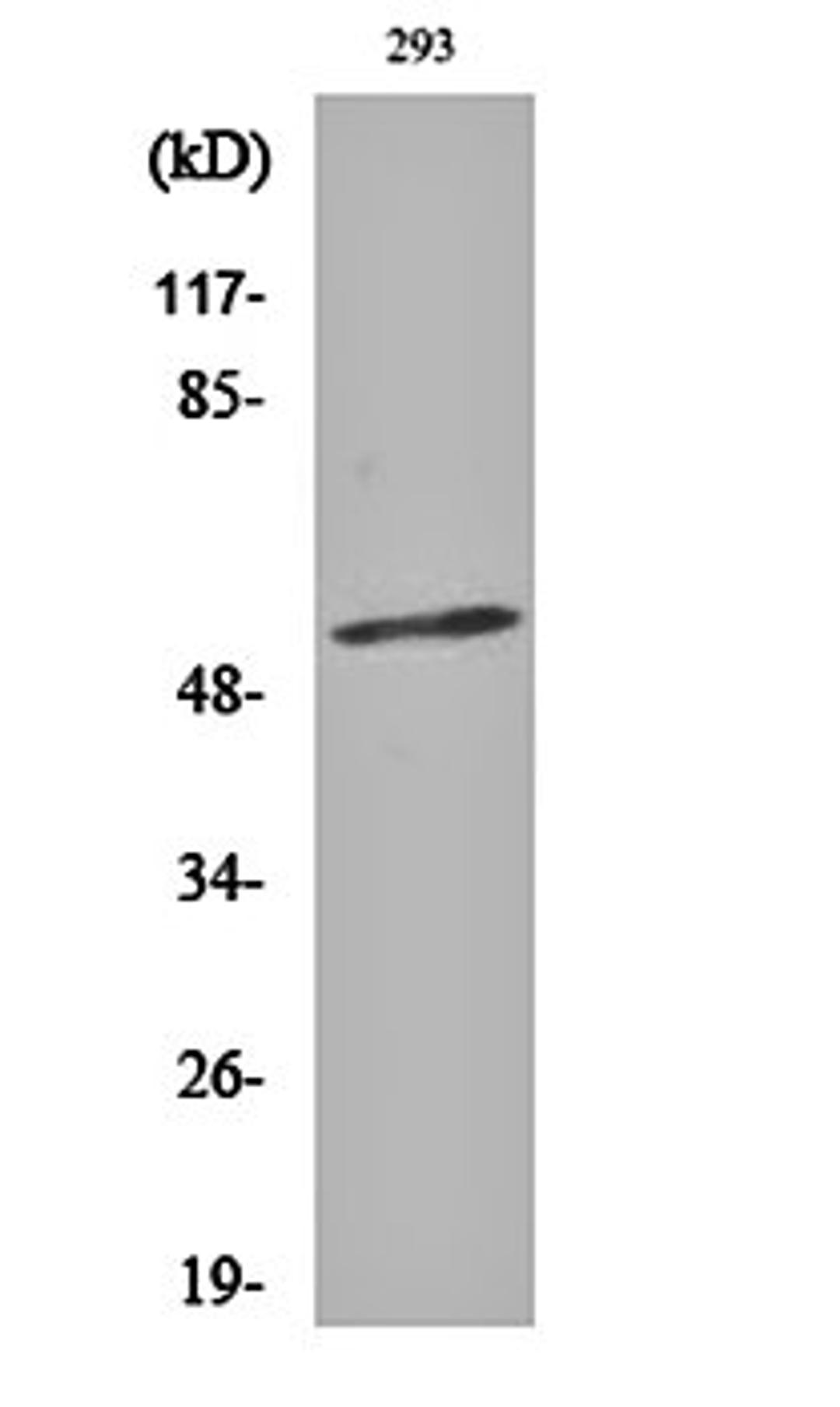 Western blot analysis of 293 cell lysates using Synaptotagmin 1/2 (phospho-T202/199) antibody