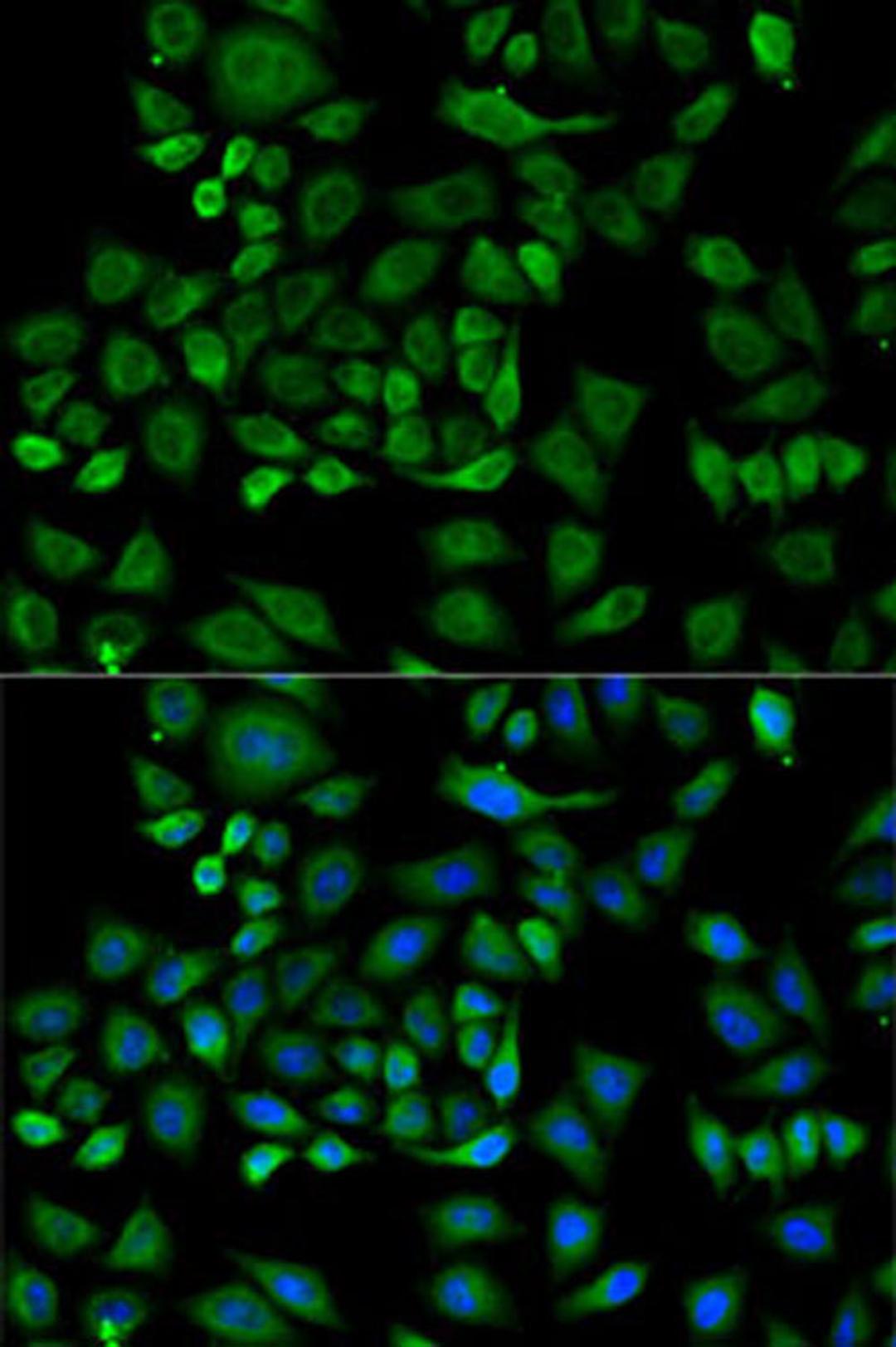 Immunofluorescence - HP antibody (A14186)