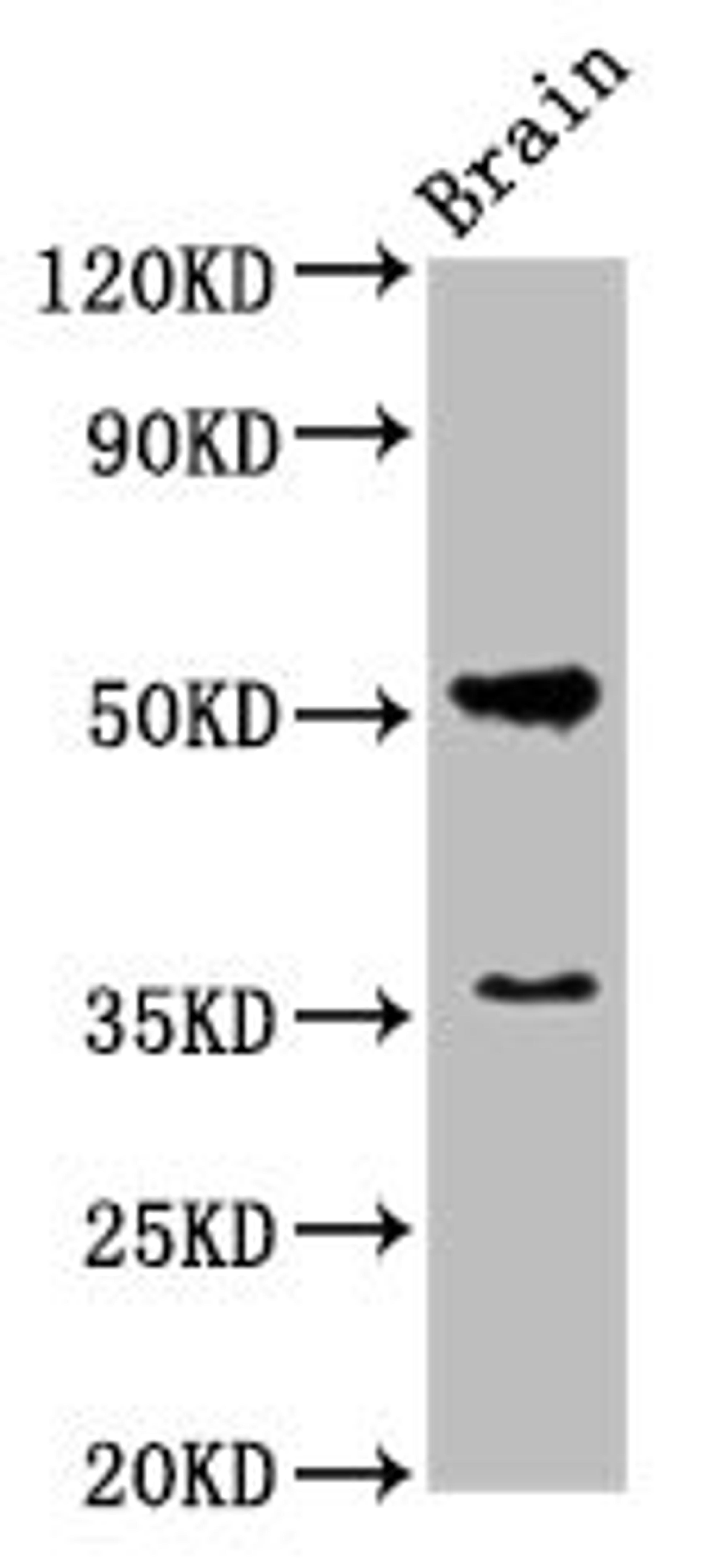 Western Blot. Positive WB detected in: Rat brain tissue. All lanes: Chrm1 antibody at 5.5µg/ml. Secondary. Goat polyclonal to rabbit IgG at 1/50000 dilution. Predicted band size: 52 kDa. Observed band size: 52 kDa