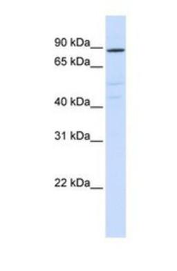 Western Blot: ATP6V0A2 Antibody [NBP1-59069] - Hela tissue lysate at a concentration of 1ug/ml.