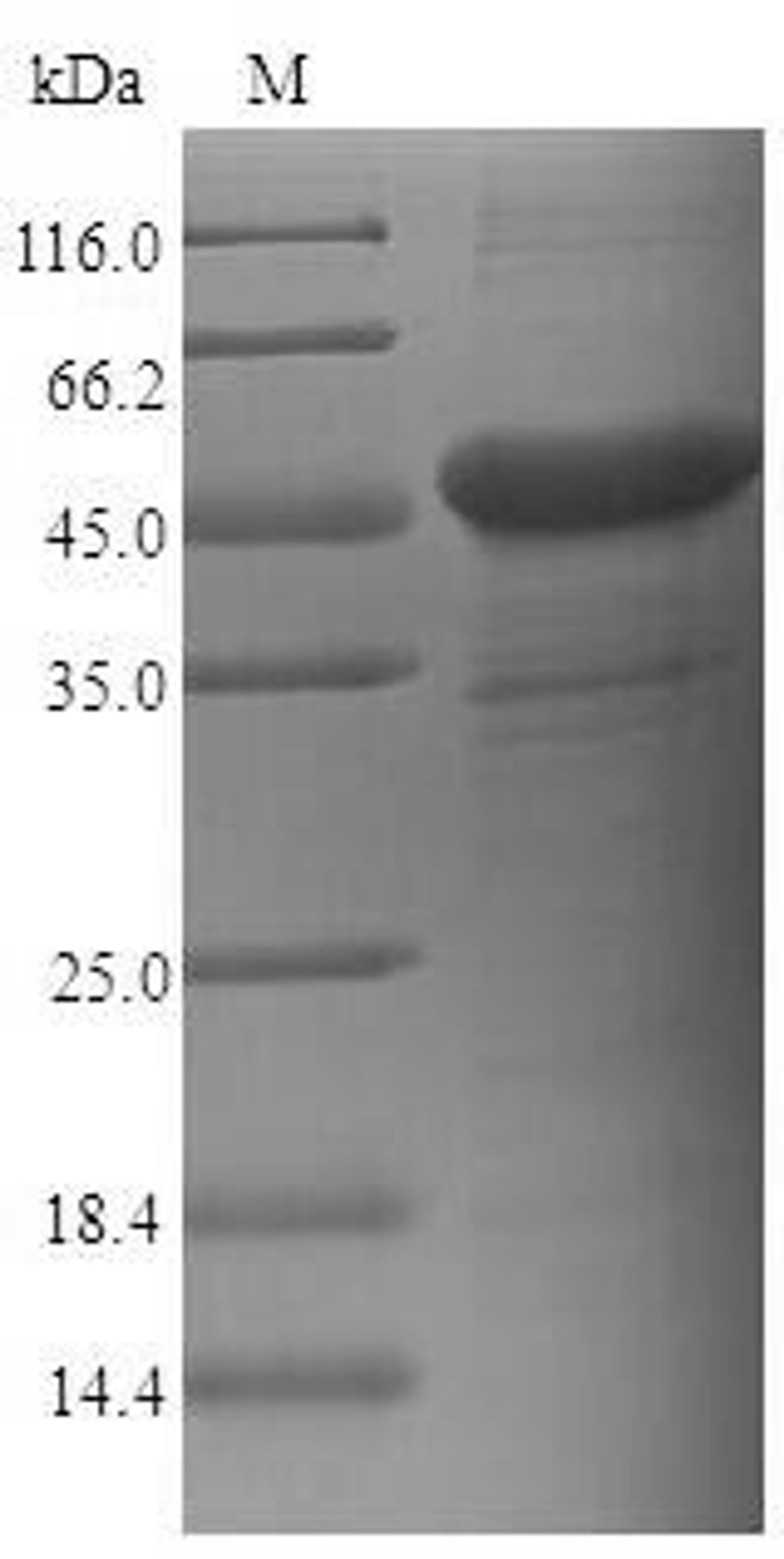 (Tris-Glycine gel) Discontinuous SDS-PAGE (reduced) with 5% enrichment gel and 15% separation gel.