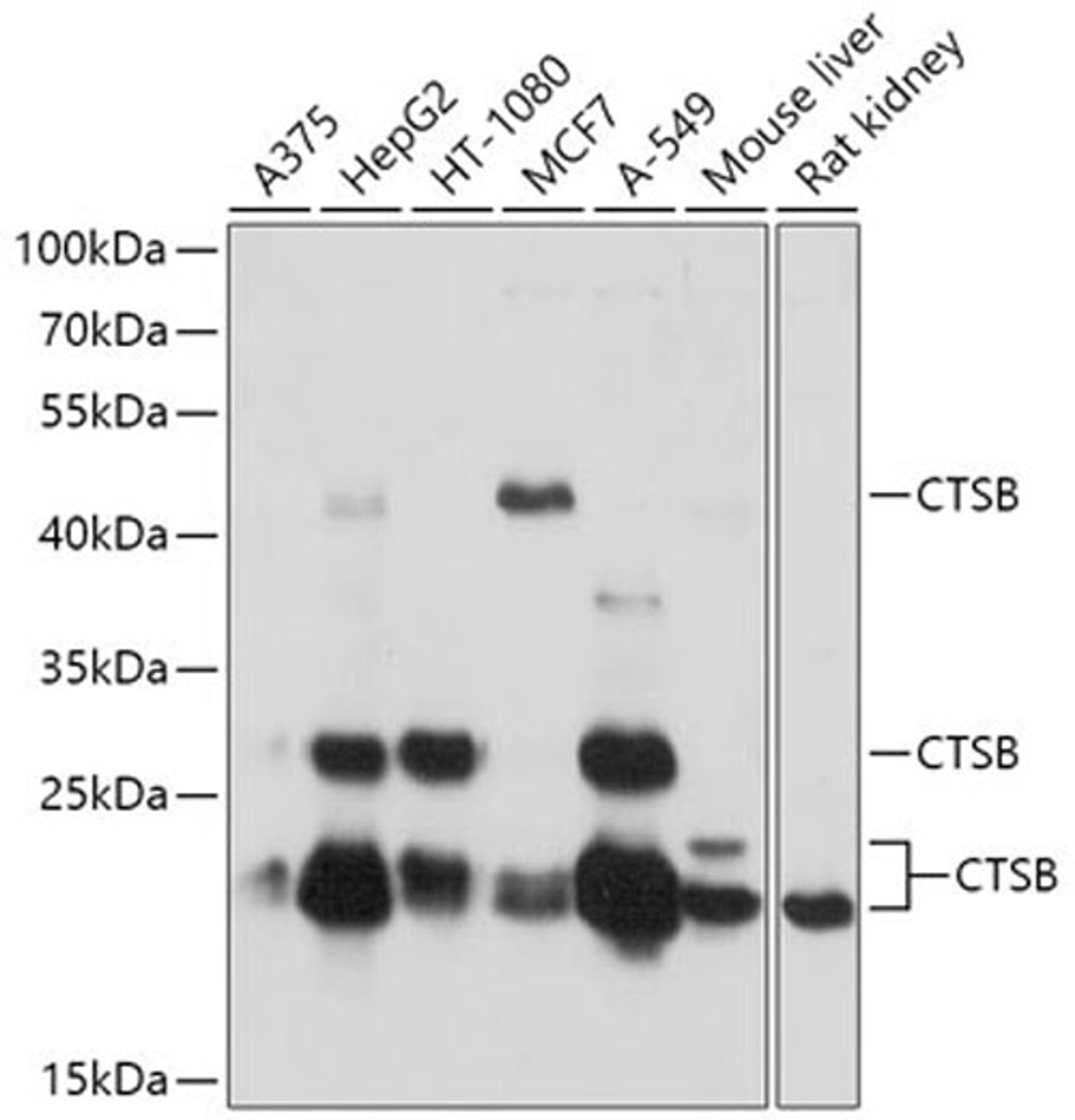 Western blot - CTSB antibody (A0967)