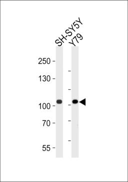 Western blot analysis of lysates from SH-SY5Y, Y79 cell line (from left to right), using CDH8 Antibody at 1:1000 at each lane.