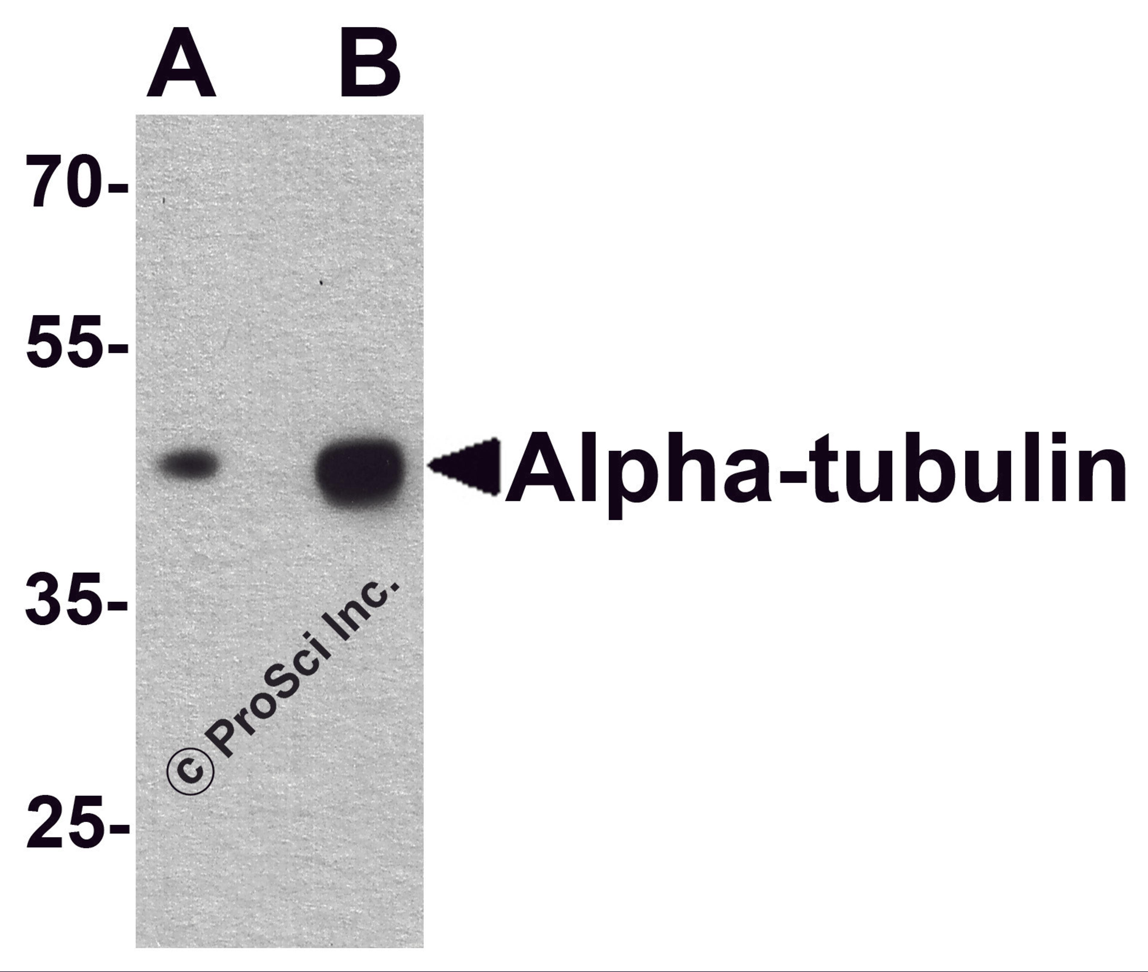 Western blot analysis of alpha-tubulin in human brain tissue lysate with alpha-tubulin antibody at (A) 0.25 and (B) 0.5 &#956;g/ml.