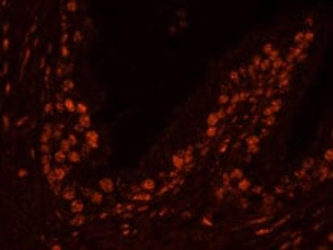 Detection of human USP47 by immunohistochemistry.