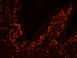 Detection of human USP47 by immunohistochemistry.