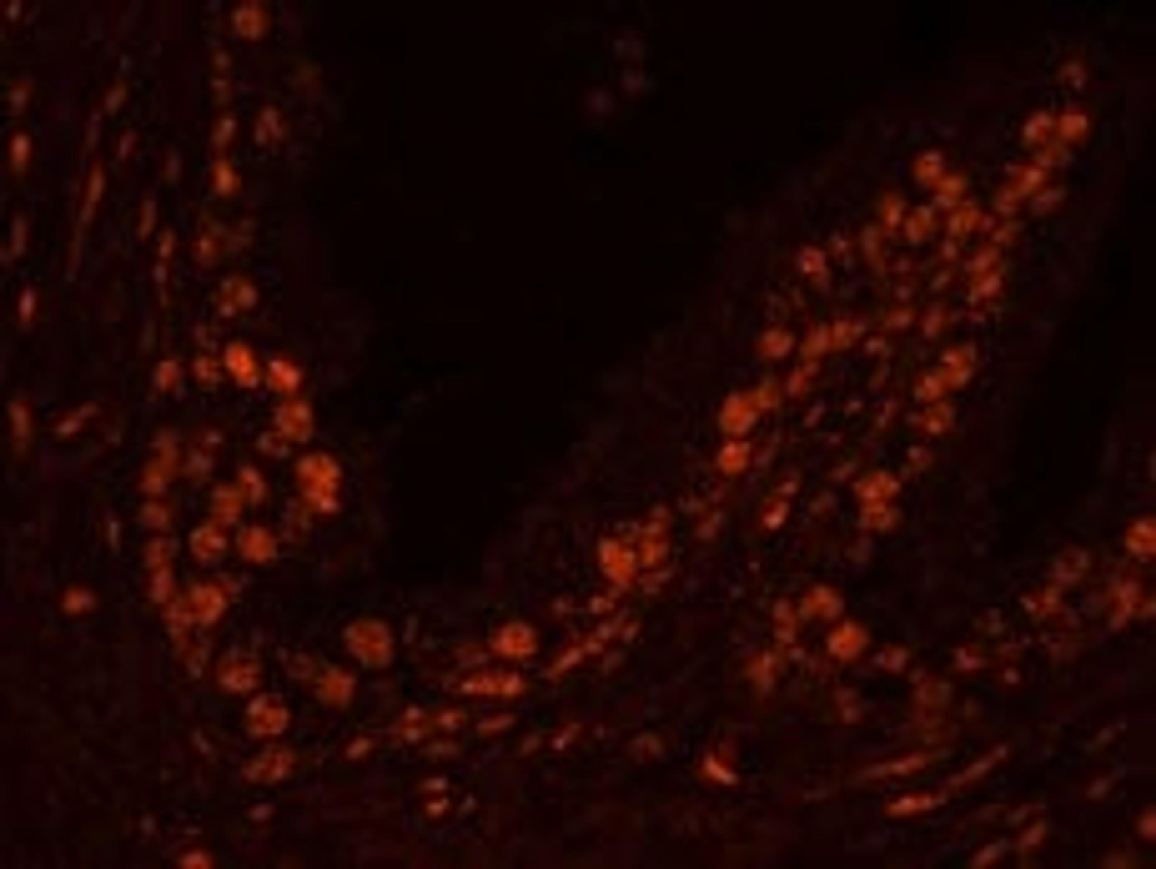 Detection of human USP47 by immunohistochemistry.