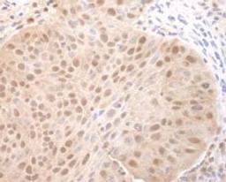 Detection of human CDC6 by immunohistochemistry.