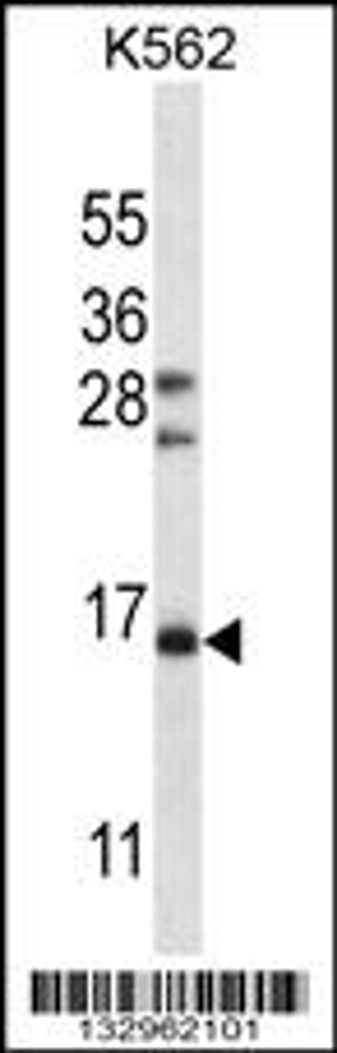 Western blot analysis in K562 cell line lysates (35ug/lane).