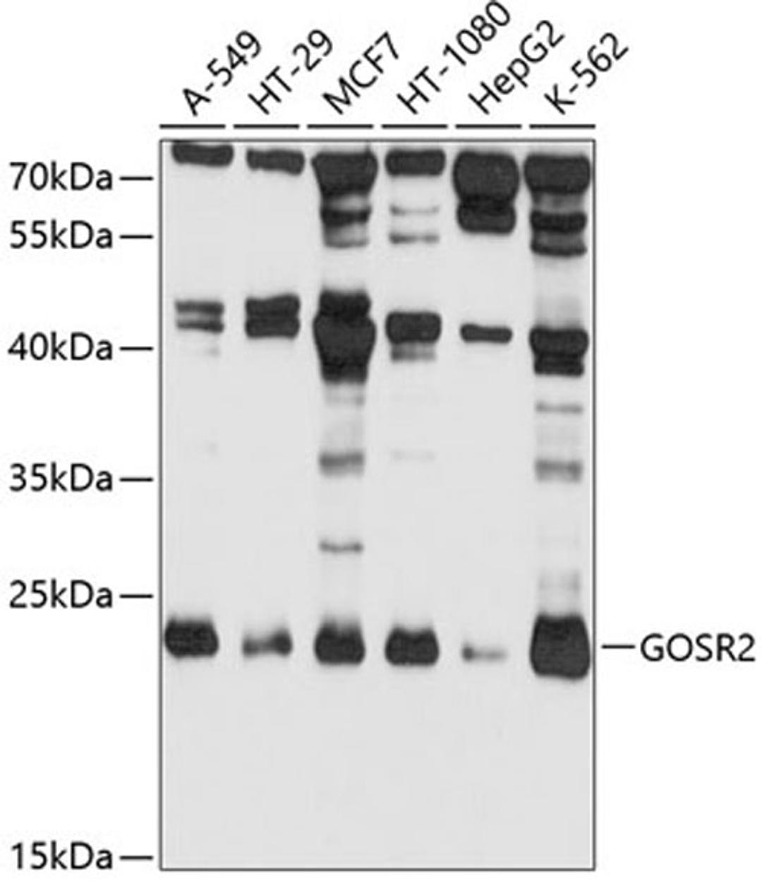 Western blot - GOSR2 antibody (A4321)