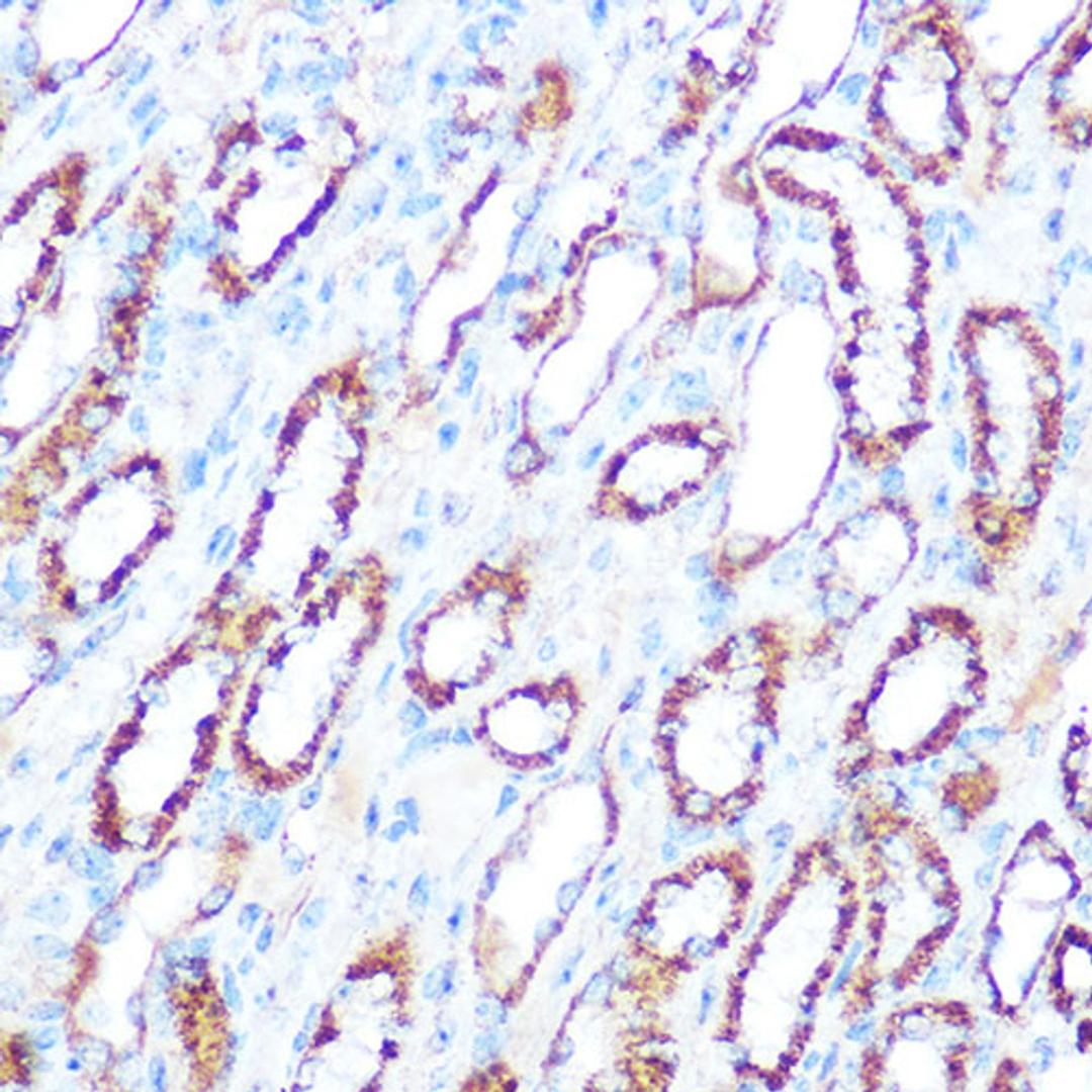 Immunohistochemistry  - NOS2 antibody (A14031)