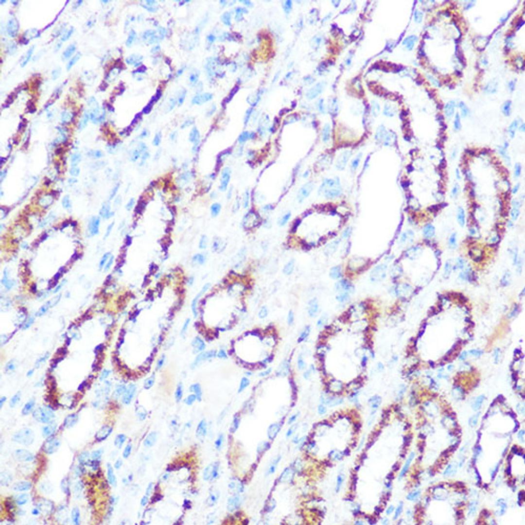 Immunohistochemistry - NOS2 antibody (A14031)