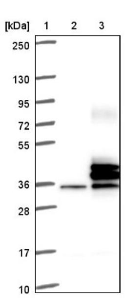 Western Blot: Stanniocalcin 2 Antibody [NBP1-92447] - Lane 1: Marker [kDa] 250, 130, 95, 72, 55, 36, 28, 17, 10<br/>Lane 2: Negative control (vector only transfected HEK293T lysate)<br/>Lane 3: Over-expression lysate (Co-expressed with a C-terminal myc-DDK tag (~3.1 kDa) in mammalian HEK293T cells, LY401224)