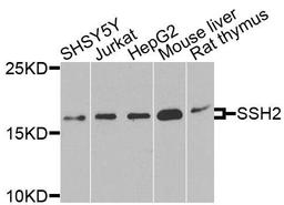 Western blot analysis of extracts of various cells using SSH2 antibody