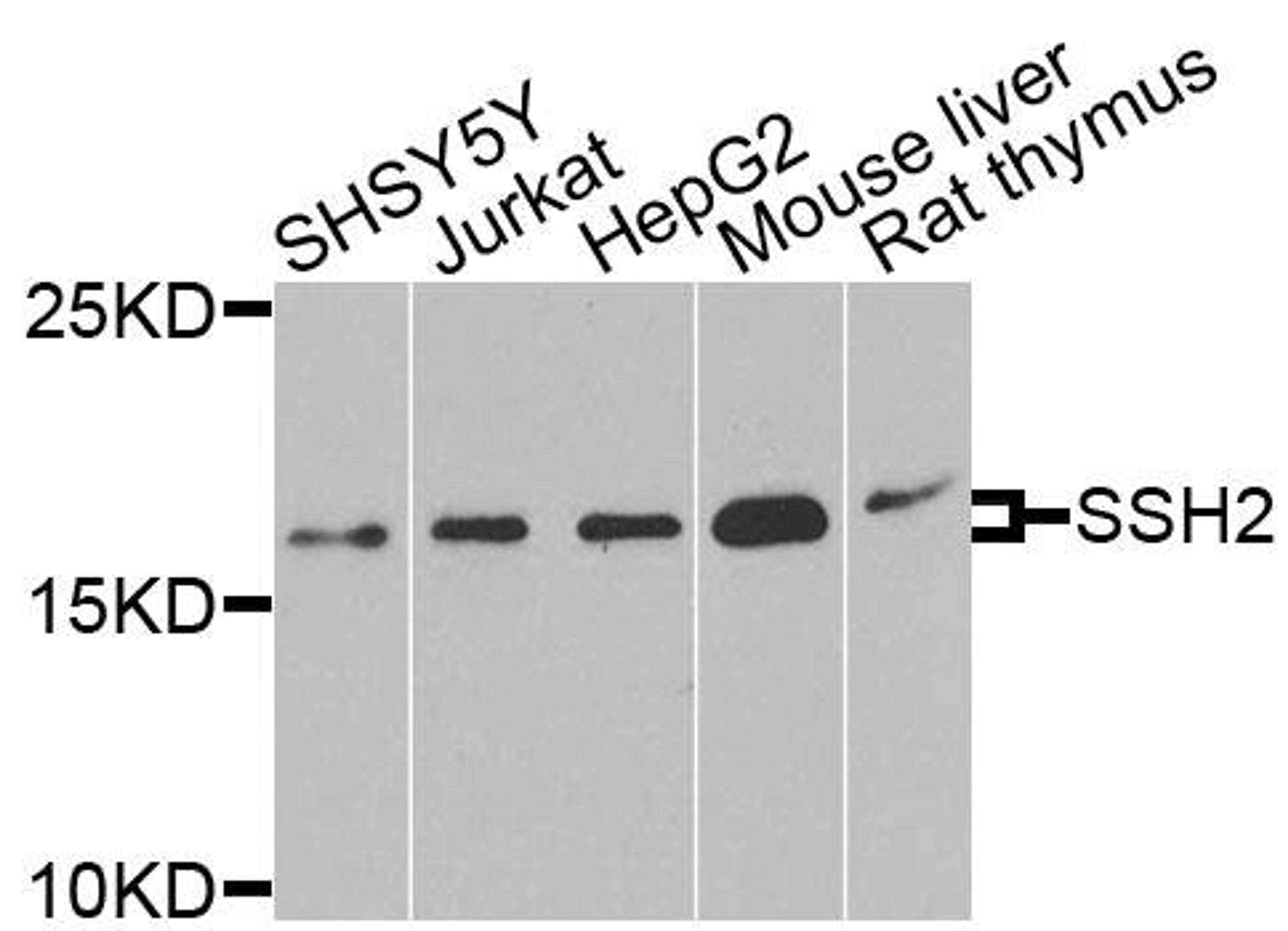 Western blot analysis of extracts of various cells using SSH2 antibody