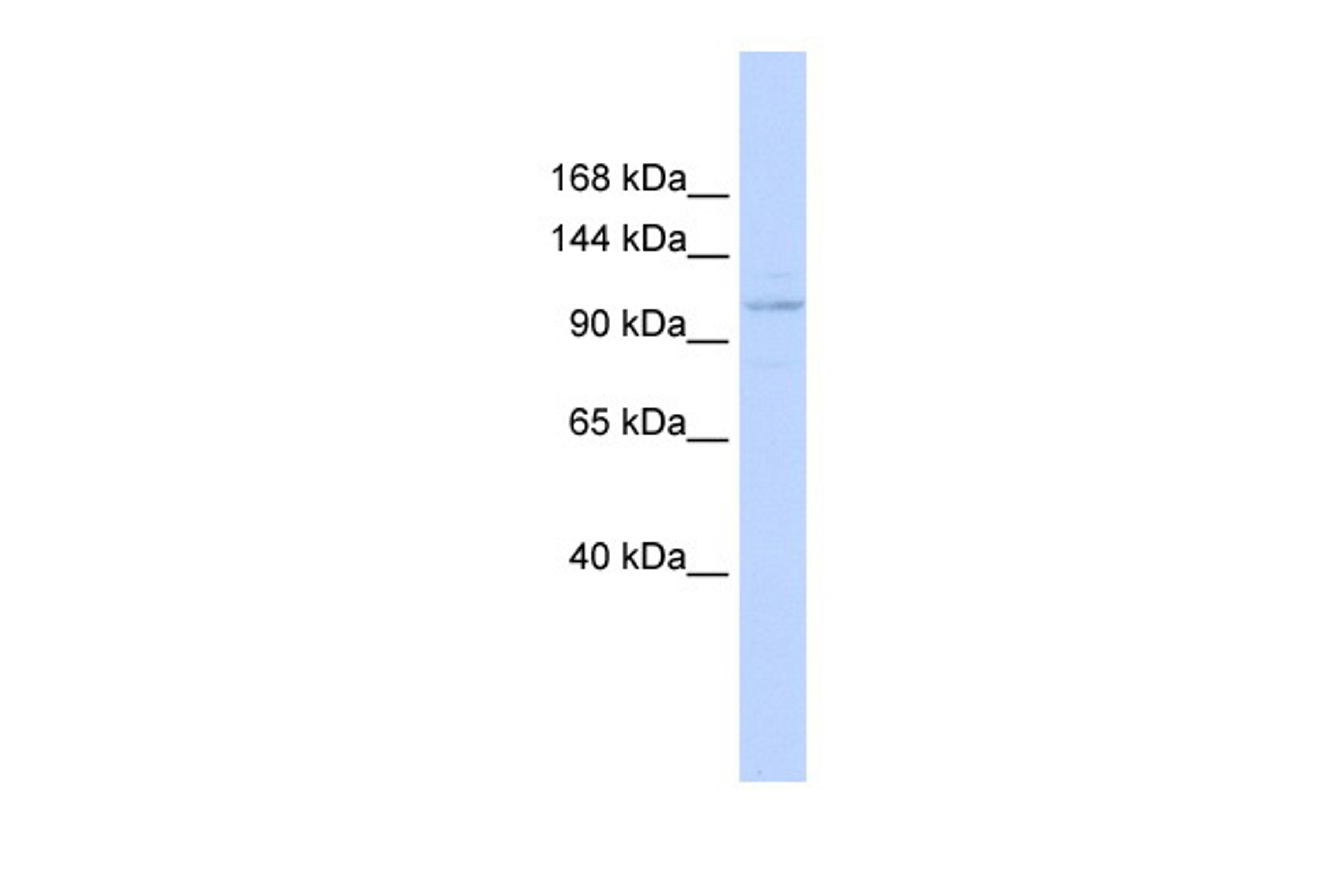 Antibody used in WB on Human HeLa at 0.2-1 ug/ml.