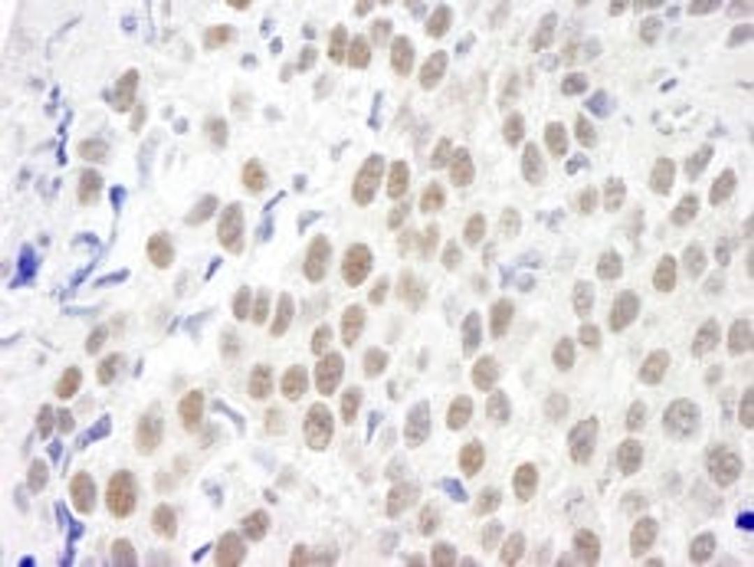 Detection of human KIAA0082 by immunohistochemistry.