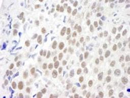 Detection of human KIAA0082 by immunohistochemistry.