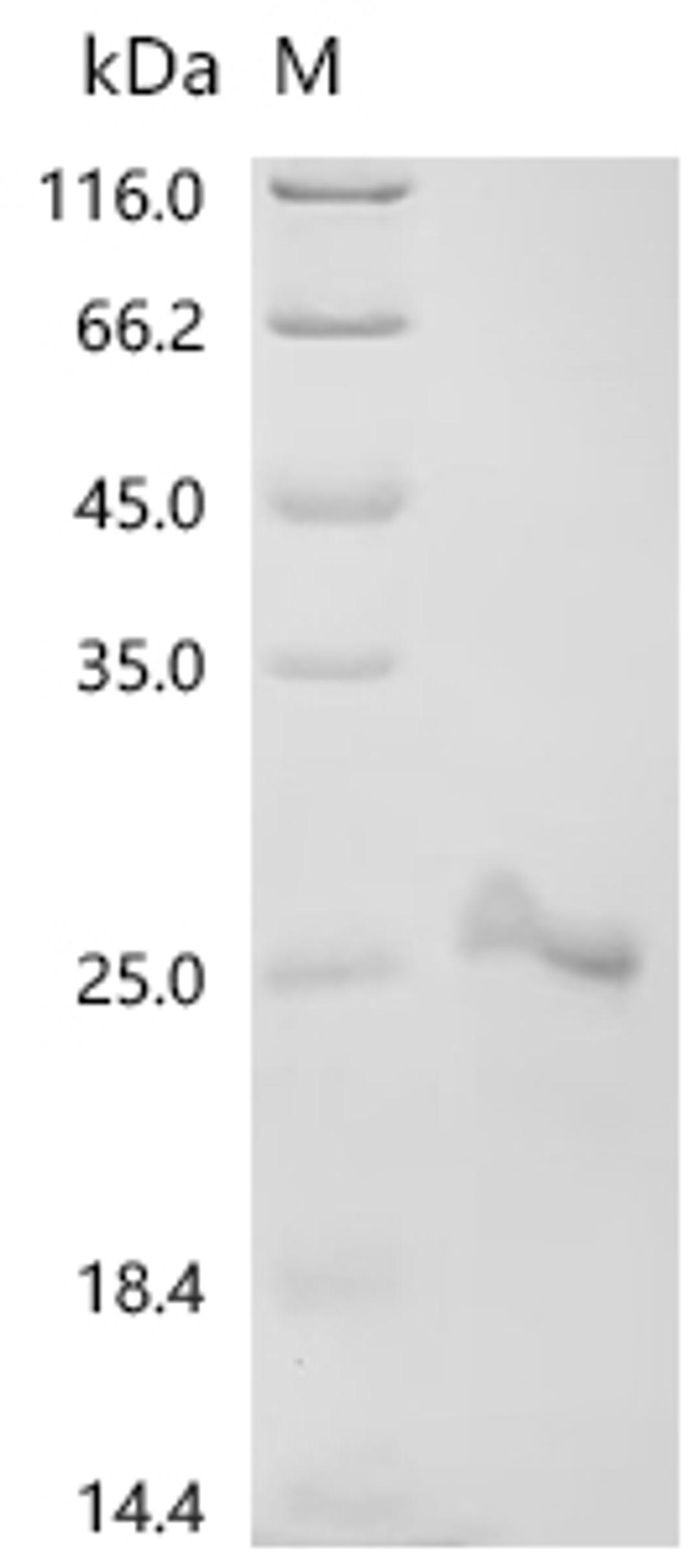 (Tris-Glycine gel) Discontinuous SDS-PAGE (reduced) with 5% enrichment gel and 15% separation gel.
