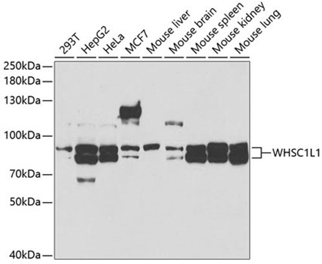 Western blot - WHSC1L1 antibody (A5577)