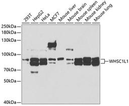 Western blot - WHSC1L1 antibody (A5577)