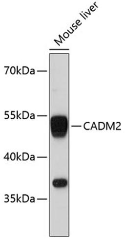 Western blot - CADM2 antibody (A11724)