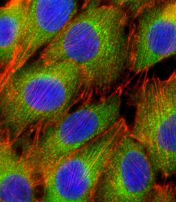 Fluorescent confocal image of C2C12 cell stained with AKT2 Antibody .C2C12 cells were fixed with 4% PFA (20 min), permeabilized with Triton X-100 (0.1%, 10 min), then incubated with AKT2 primary antibody (1:25). For secondary antibody, Alexa Fluor 488 con