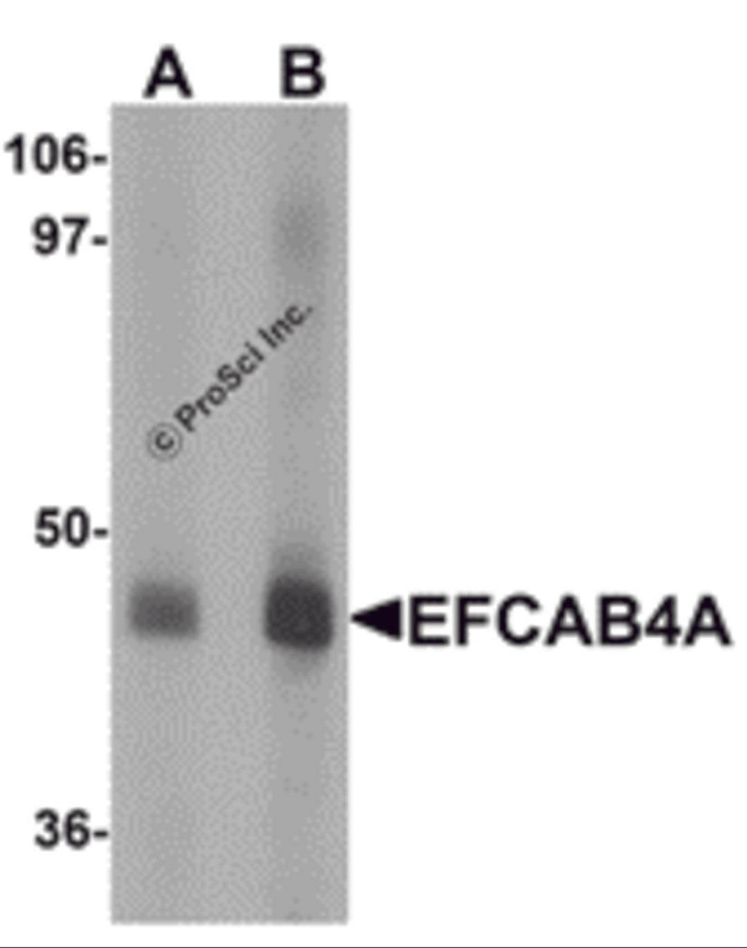 Western blot analysis of EFCAB4A in human lung tissue lysate with EFCAB4A antibody at (A) 1 and (B) 2 μg/mL.