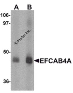 Western blot analysis of EFCAB4A in human lung tissue lysate with EFCAB4A antibody at (A) 1 and (B) 2 μg/mL.