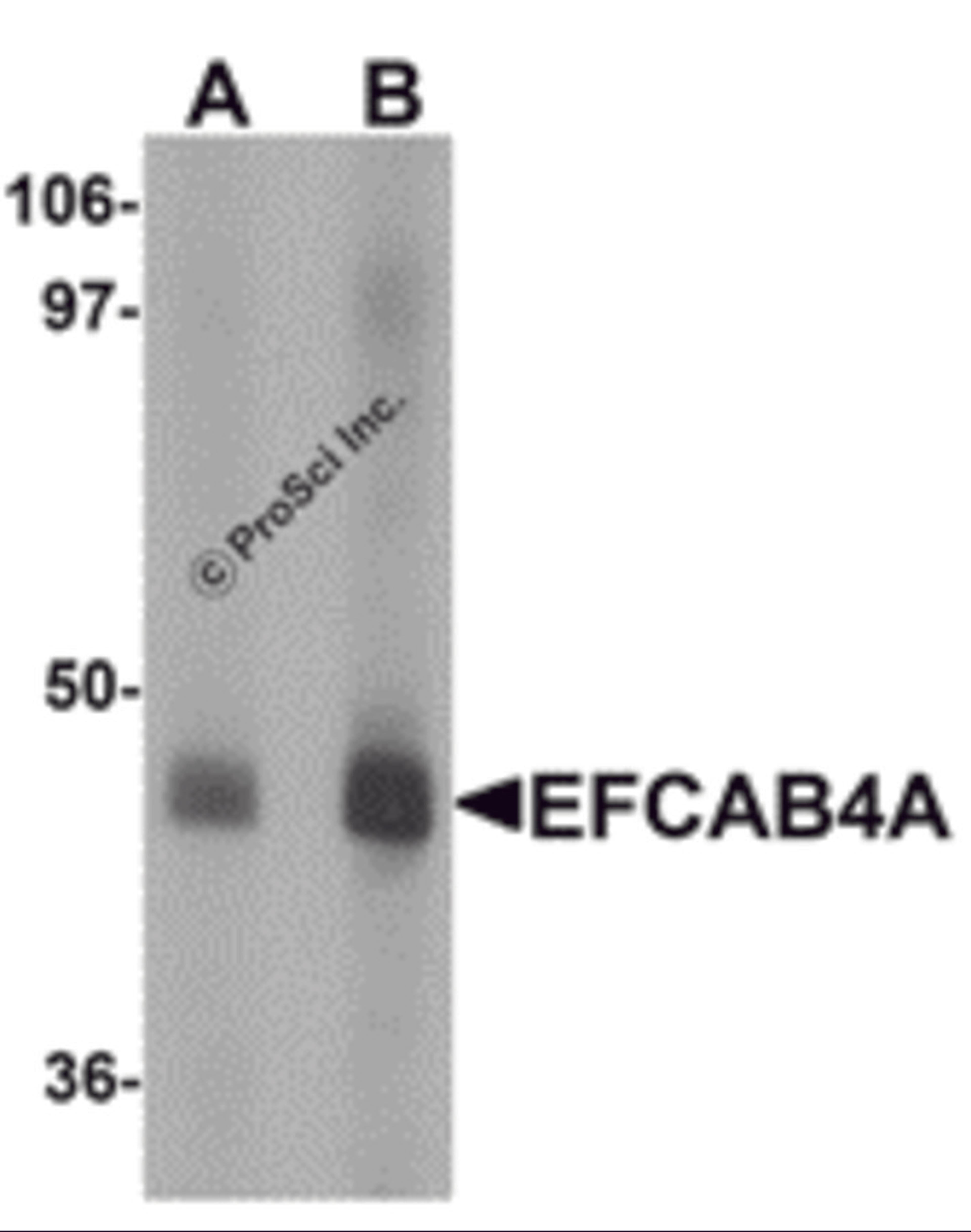 Western blot analysis of EFCAB4A in human lung tissue lysate with EFCAB4A antibody at (A) 1 and (B) 2 μg/mL.