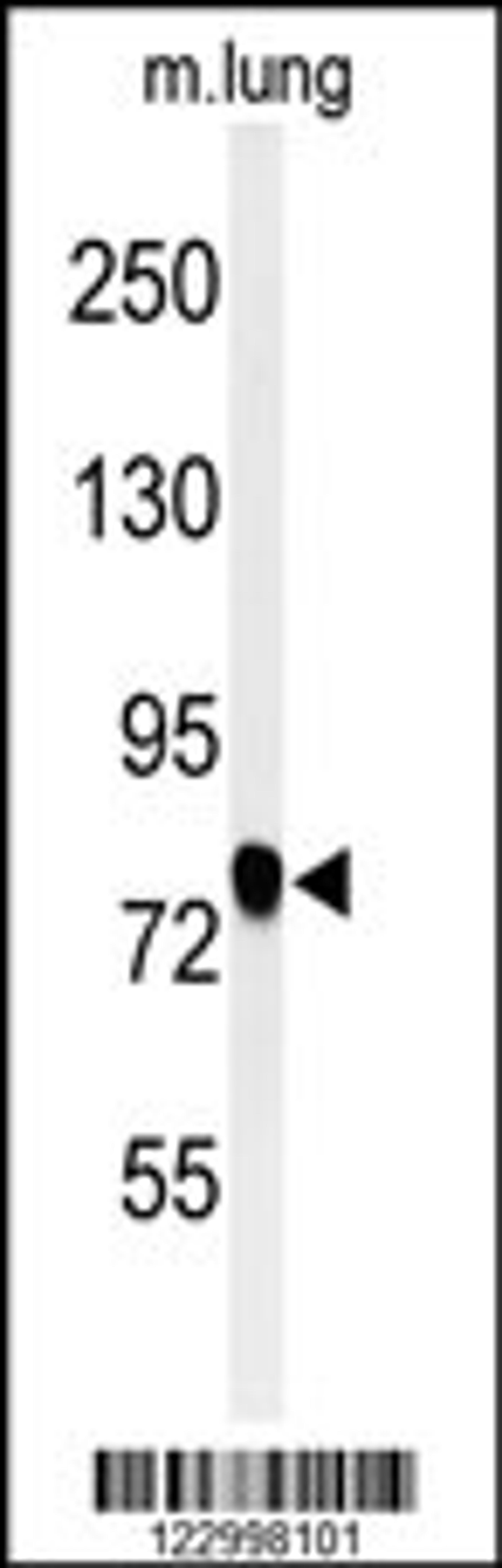 Western blot analysis of SEMA3C Antibody in mouse lung tissue lysates (35ug/lane)