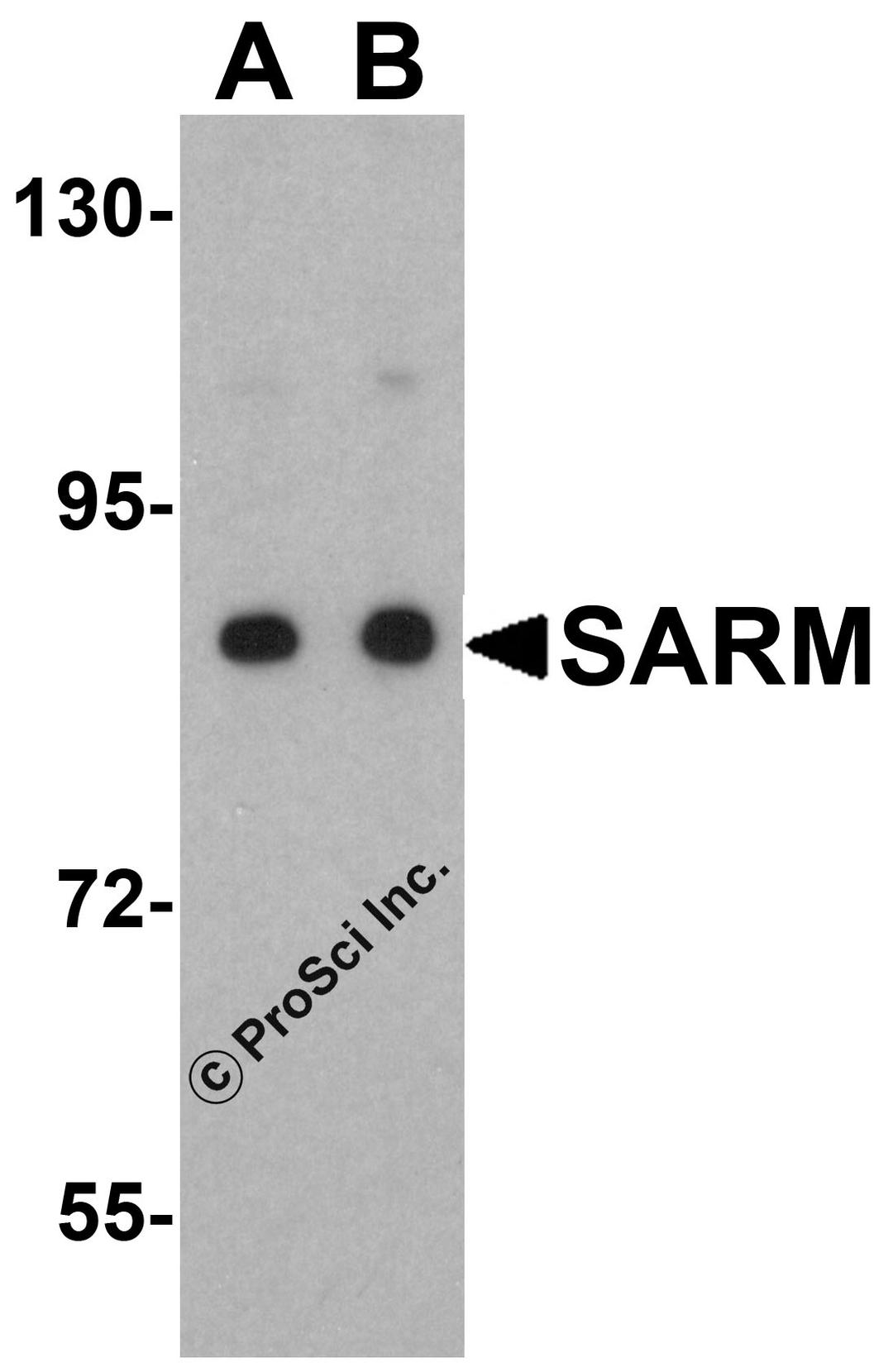 Western blot analysis of SARM in Daudi cell lysate with SARM antibody at (A) 0.5 and (B) 1 μg/mL.