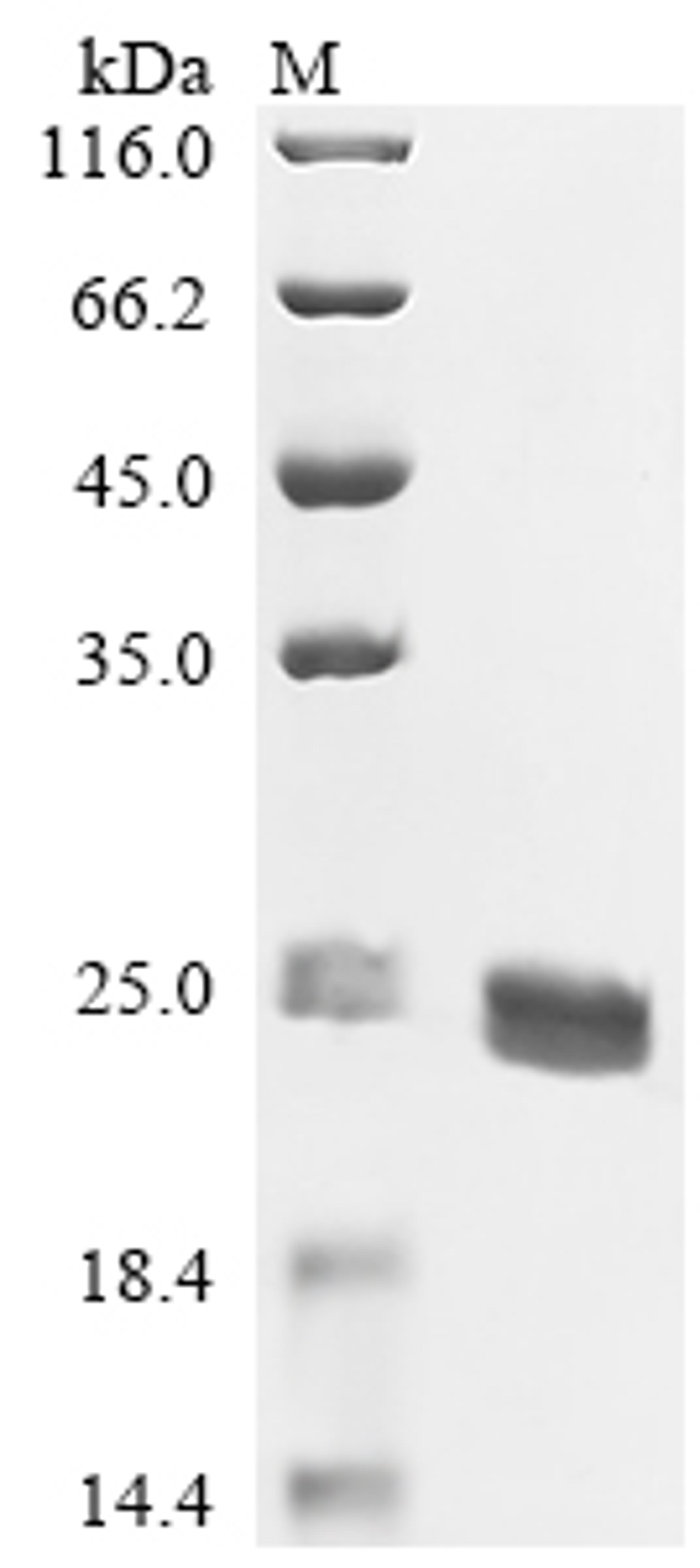 (Tris-Glycine gel) Discontinuous SDS-PAGE (reduced) with 5% enrichment gel and 15% separation gel.