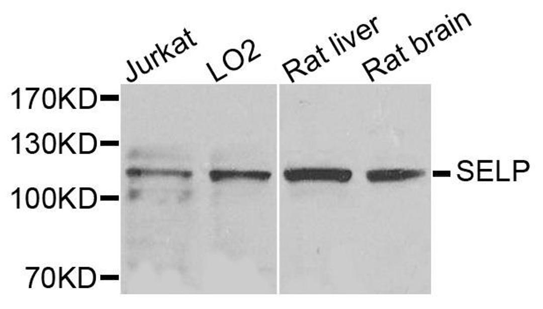 Western blot analysis of extracts of various cells using SELP antibody